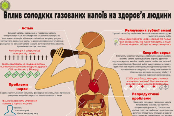 Вплив солодких газованих напоїв на здоров'я людини (інфографіка)
